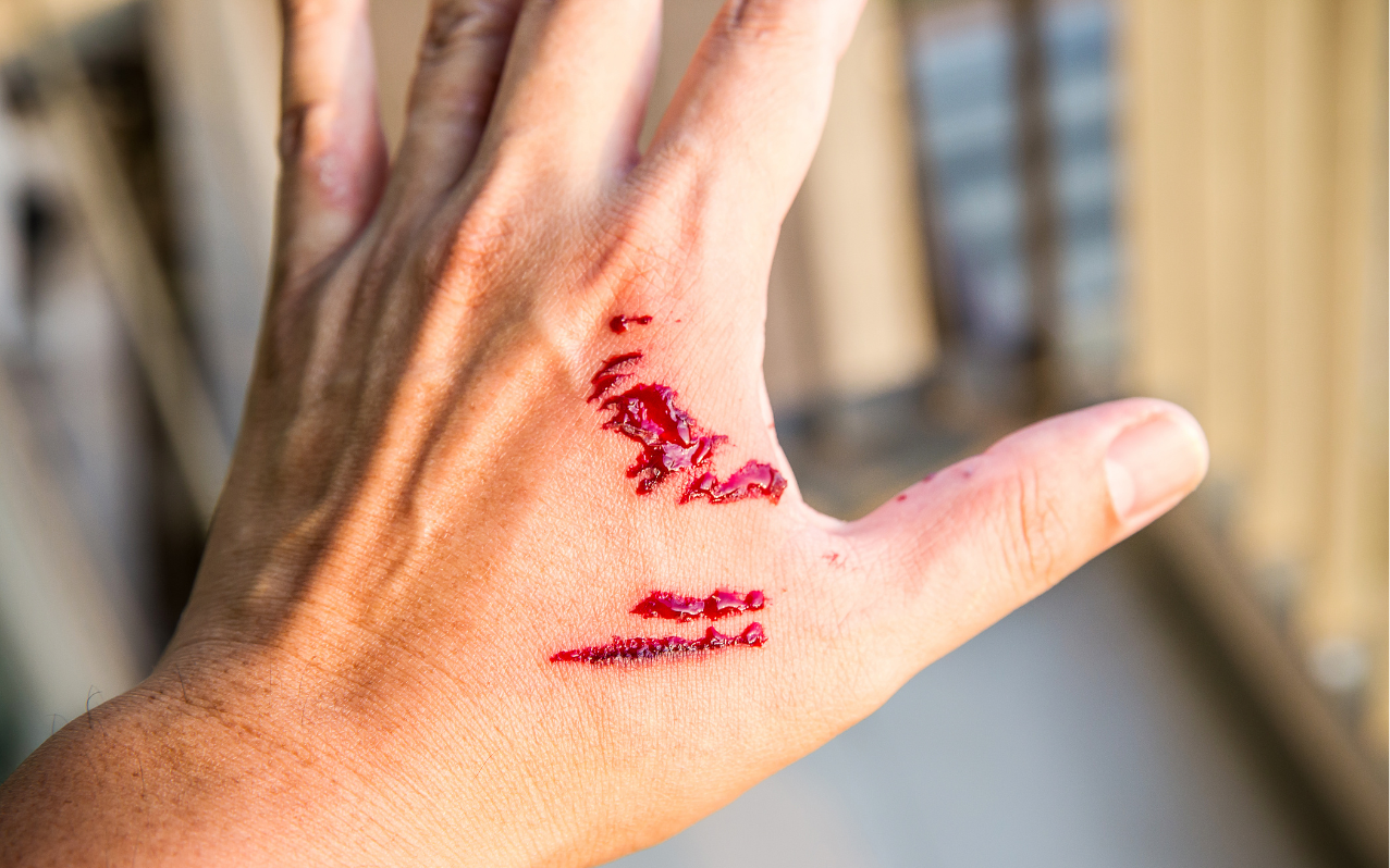 Ảnh minh họa: Getty Images